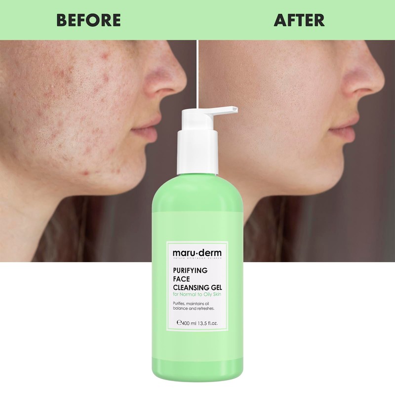 Maruderm Salicylic Acid Face Wash Gel Especially for Combination and