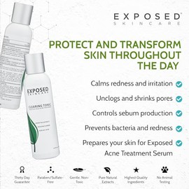 Acne Clearing Tonic Treatment Toner by Exposed Skin Care, Salicylic Acid 1 with Green Tea Extract                                                     