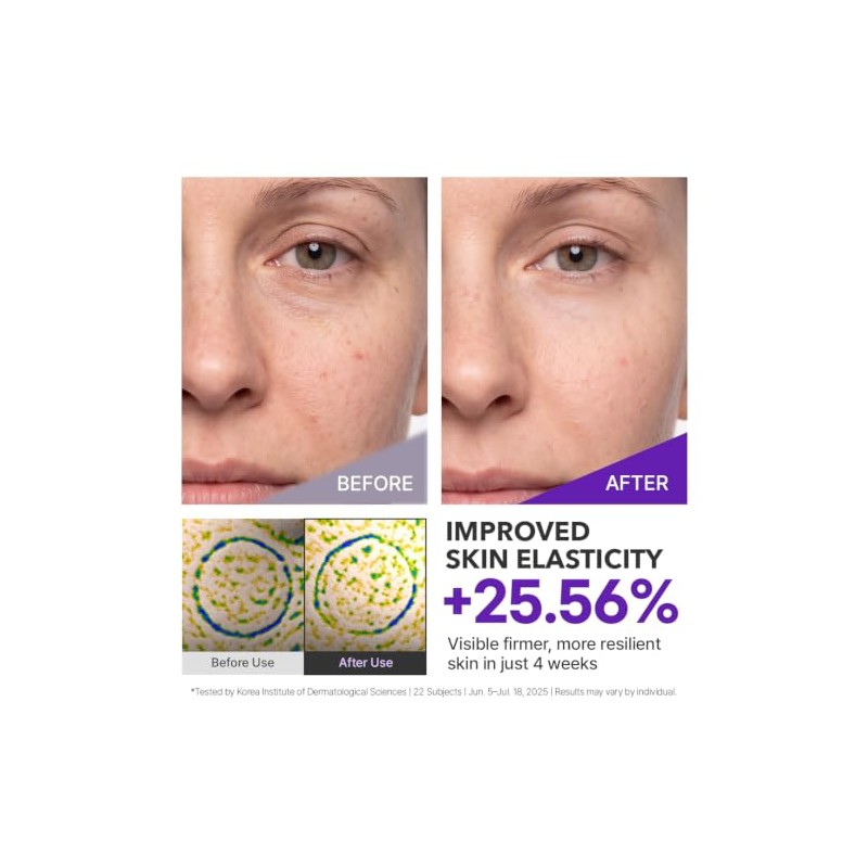 Centellian24 Expert Madeca Cream Active Renew PDRN, 50 ml