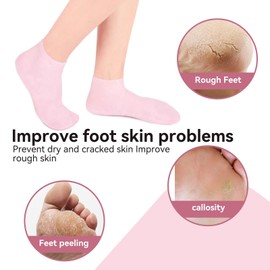 Moisturizing Socks Overnight, 2 Pairs Moisture Gel Socks Moisturising Foot Socks for Women and Men Toe Spa Lotion Moisture Socks for Dry Hard Cracked Skin Moisturizing Day Night Care Skin (L(39-41))