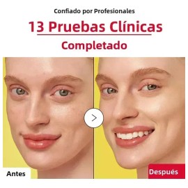 Sdfs Jfghh Vc Essence Mejora La Opacidad Descuento