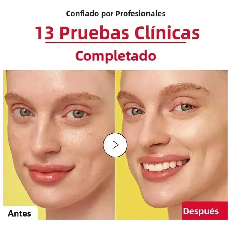 Sdfs Jfghh Vc Essence Mejora La Opacidad Descuento