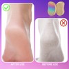 Foot File, Foot Files for Callus, Stainless Steel Callus Remover,