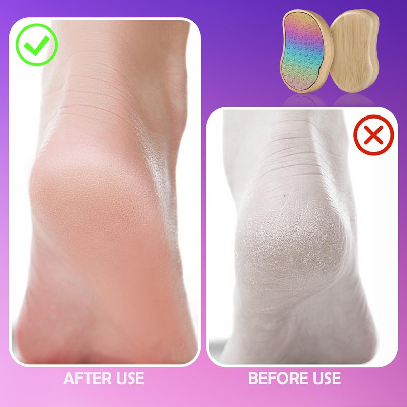 Foot File, Foot Files for Callus, Stainless Steel Callus Remover,