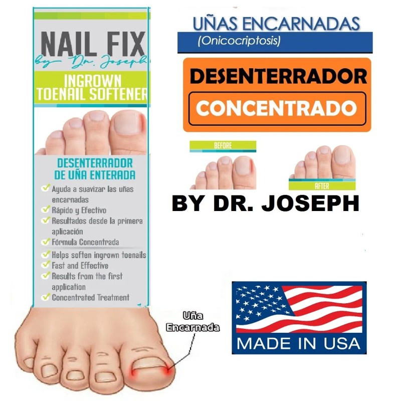 Nailfix Desenterrador de Uñas Nailfix INGROWN NAILS Removal TOE-NAIL