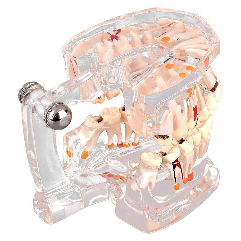 Standard Dental Model for Dentistry Students, Standard Study Teaching Dental