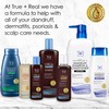 True+Real Coal Tar Therapeutic Plus Tar Gel Anti-Dandruff Shampoo Original