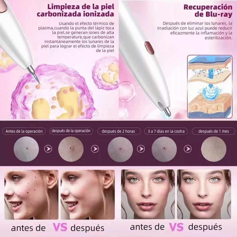 Beauty start Cauterizador Verrugas Lunares Plasma Pen + Kit De
