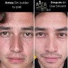 Kit Facial Smooth Skin Care Para Hombre Piel Mixta A