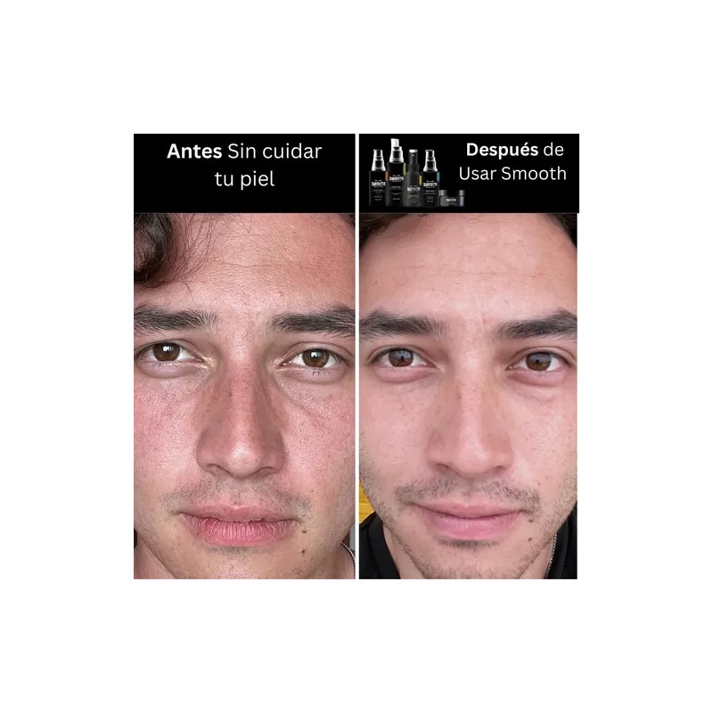 Kit Facial Smooth Skin Care Para Hombre Piel Mixta A