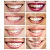 Teeth Whitening Gel Syringe Dispensers 35% Carbamide Peroxide, Tooth Bleaching