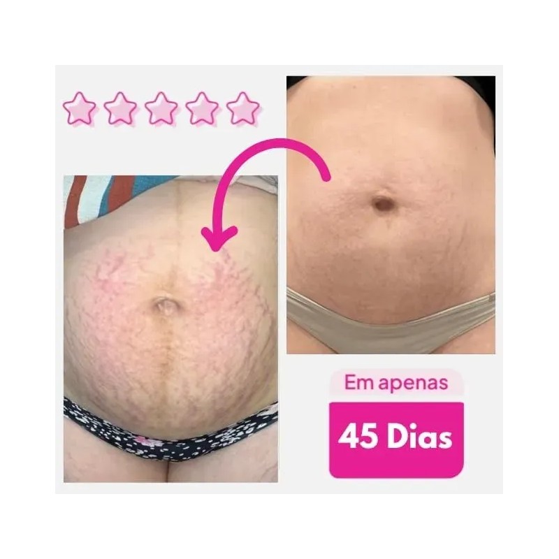 Crema Corporal Reafirmante 300g Anticelulitis Y Estrías Neutra