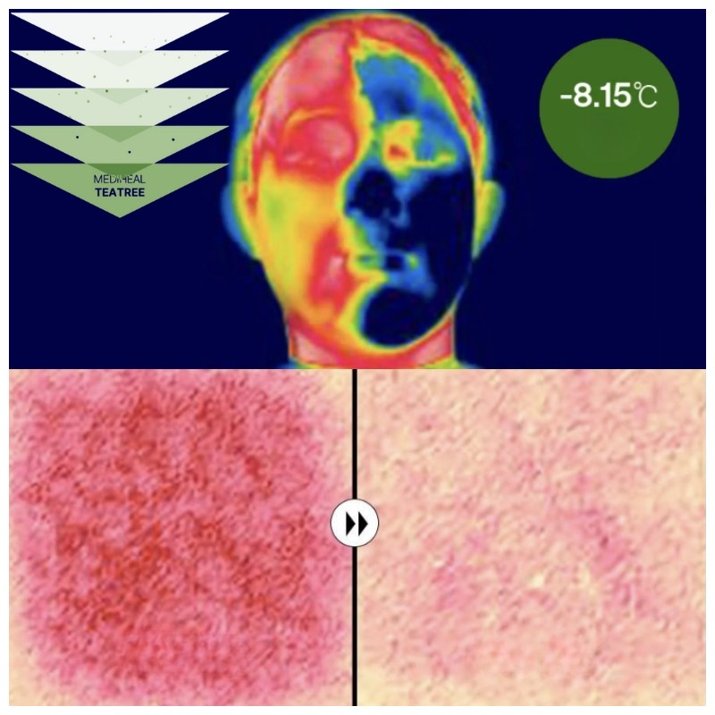 MEDIHEAL Essential Mask 24ml*10ea, Type:Ceramide