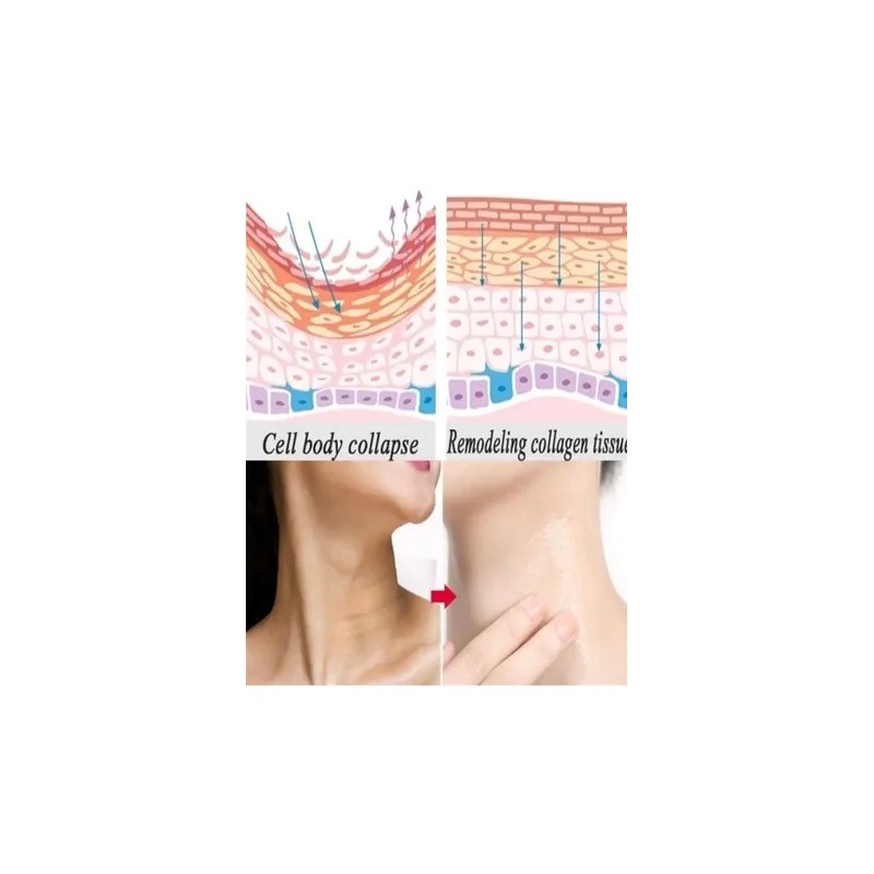 Crema Gel Adelgaza Papada Cuello Escote Reafirma Colageno 40