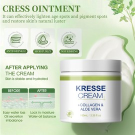 Miioto Kressesalbe, Kressesalbe Gegen Altersflecken, Kresse Salbe Gesichtscreme, Aktiv Kressesalbe, Bekämpft Hyperpigmentierung, Altersflecken Entfernen-100ML