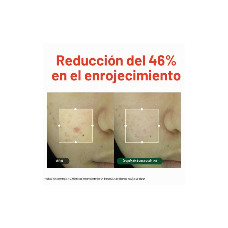 Dr.G NEW RED Blemish Clear Soothing Cream (70ml 2.36 oz)