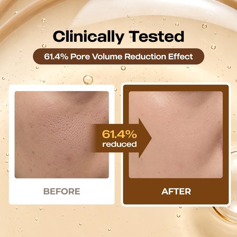 Almohadilla Pore‑T PAD6 – Tónico exfoliante que cierra poros y