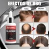 Líquido Para Crecimiento 5% + Biotina Para Barba, Cabello