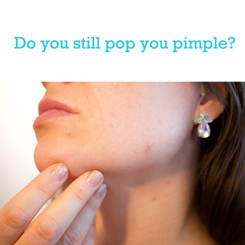 Comedone Squeezer, Pack of 2 Comodone Remover, Pimple Needle, Needle