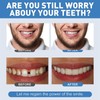 Soft Denture Reline Kit,False Teeth,Snap on Dentures Upper and Lower