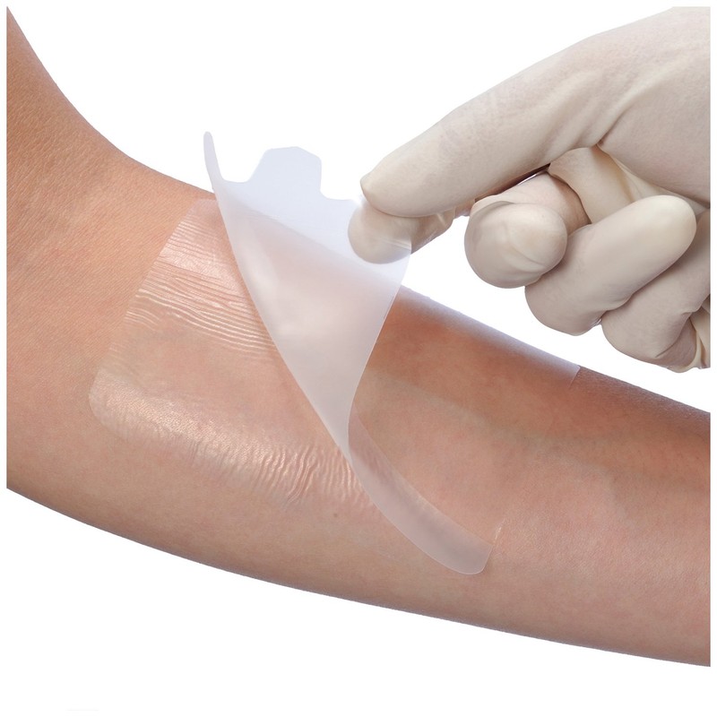 Alcare 16391 Multi-Fix Breathable and Waterproof Surgical Film, No. 2,