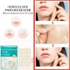 Parches Invisibles Cubre Acne Espinillas Granos Facial 72p F