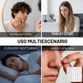 MYDEAR 360pcs Parches para Acné, Parches Hidrocoloides para Espinillas, Calcomanías Ultra Finas para Cara y Piel, Tratamiento Antiimperfecciones con Tecnología Hidrocoloide Avanzada Facial (C)