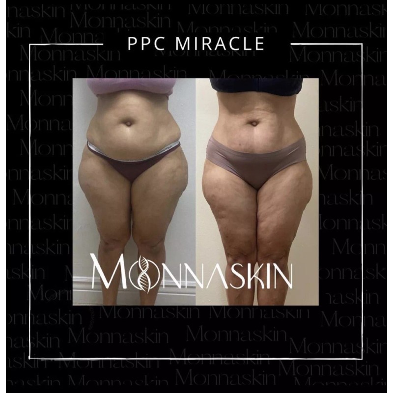 Monnaskin MESOLIPO PPC Cream Monnaskin 50g