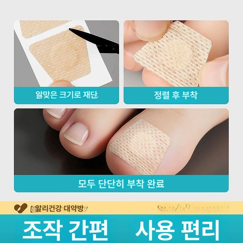 BINEL 발톱무좀밴드 문제성 손발톱 네일 집중케어 BINEL Nail Fungal Infection