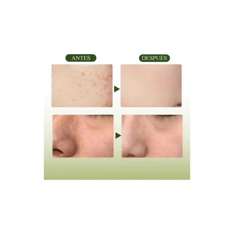 Mascarilla De Arcilla De Té Verde - Limpieza Profunda, Elimina