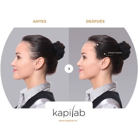 Kapilab Scalp Mask Roots Powder 4 g - Black - Conceals Thin Hair for First Use - Hair Concealer for Men and Women - Waterproof Hair Makeup