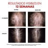Vichy Dercos Regen Serum 90ml Para Cuidado Capilar