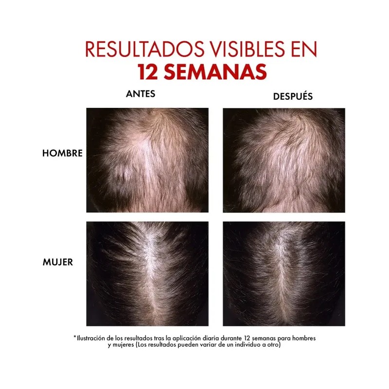 Vichy Dercos Regen Serum 90ml Para Cuidado Capilar