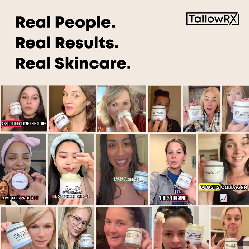 TALLOWRX Tallow Body Lotion – 100% Grass-Fed Beef Tallow for
