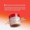 RED SUCCINEC PEELING PAD 2024