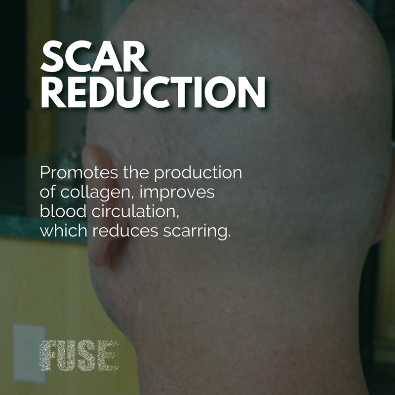 Fuse Cosmetic Pigmentation Serum - Scalp Micropigmentation Aftercare Lotion -