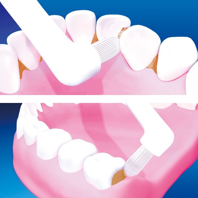 Clinica Advantage Dental Taft, 1 Piece