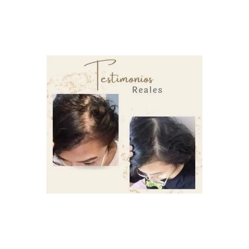 2pzs Shampoo Reviving Farmasipara Crecimiento De Cabello