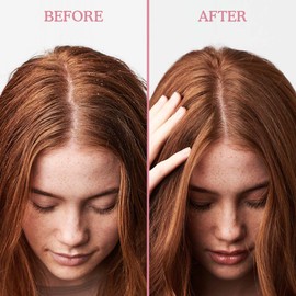 Umberto Giannini Scalp Restore Shampoo, Vegan & Cruelty Free Scalp Reviving Anti-Dandruff Formula with Super Fruit Enzymes, 250 ml