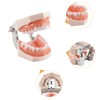 Hoite Dental Typodont Teeth Model 28 PCS Spare Teeth for