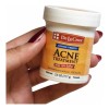 Pomada De La Cruz Sulfur Azufre Acne 73.7gr