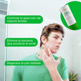 TRIOXIMED Gel Crema antiacné con aceite de girasol ozonizado trata y previene lesiones de acné; para uso facial y corporal