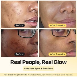 Gleamin- “Crema Facial con Vitamina C con Ceramidas, Electrolitos y Cúrcuma Para Piel Hidratante, Seca, Oscura, Vi