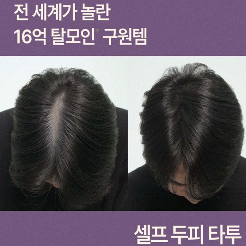 Triconics Triconix Scalp Tattoo Crown Parting Hairline Hair Loss Cover