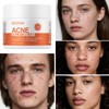 Acne Cream Multi-Acid Deep Relief – 4% Lactic Acid BHA/AHA