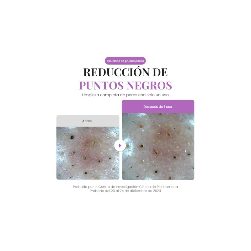 EQQUALBERRY Limpiador Facial 2 en 1 Mascarilla de Arcilla 130