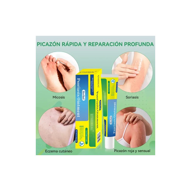 2p Crema De Psoriasis Para Varios Síntomas De Psoriasis 20g