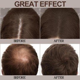 Apooliy Hairline Powder,Hair Shadow for Thinning Hair for Women and Men,Cover Gray Hair Root Touch Up Powder,Hair Shading Filler