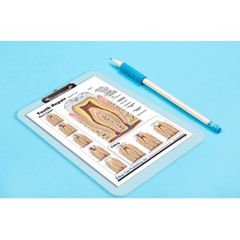 Blue Tree Publishing Tooth Repair chart with clipboard, two sided chart