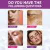 2 Piezas Crema de Urea que Decolora las Manchas, Crema